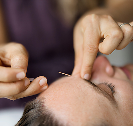 Acupuncture Women